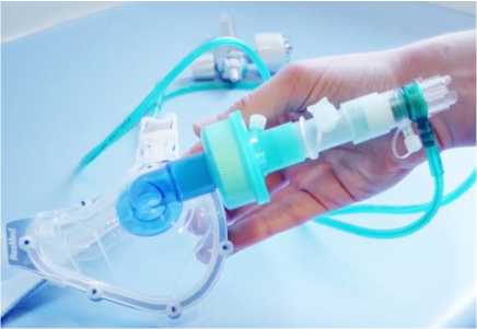 Read more about the article La valve CPAP de Boussignac, pour une VNI sans contamination